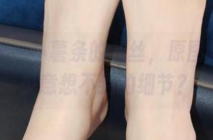 小众视觉 – 小薯条的灰丝，原图里藏着多少意想不到的细节？